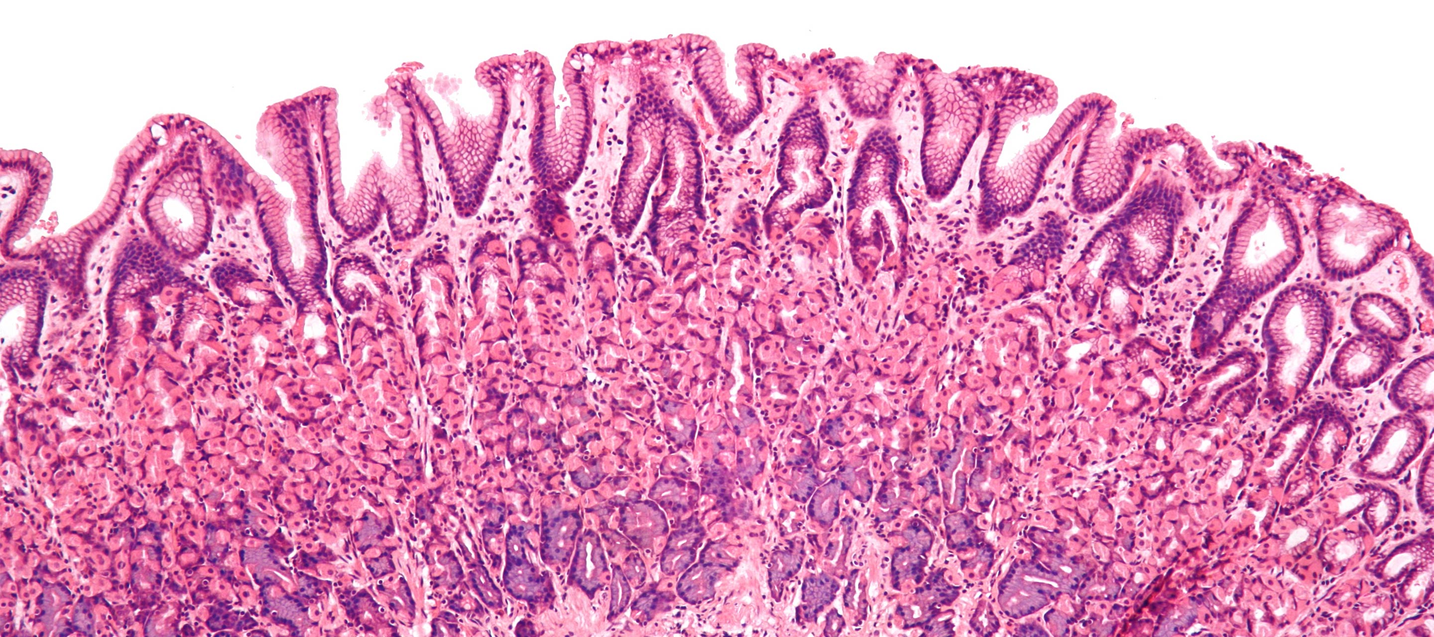 Gut lining under a microscope